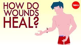 How Wounds Heal