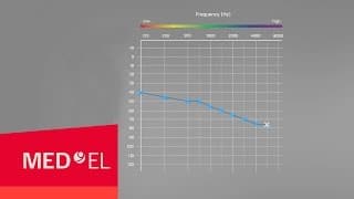 My Hearing Loss and My Audiogram